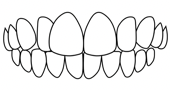 dental crossbite correction