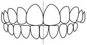 midline shift dental correction