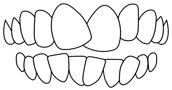 dental crowding correction