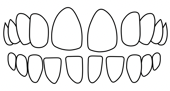 dental spacing correction