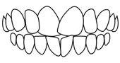 rotation of teeth correction