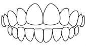 dental openbite correction