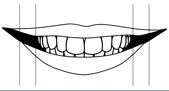 narrow smile dental correction